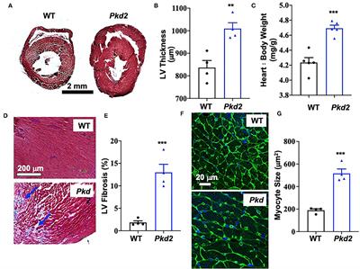 Arrhythmogenic Hearts in PKD2 Mutant Mice Are Characterized by Cardiac Fibrosis, Systolic, and Diastolic Dysfunctions